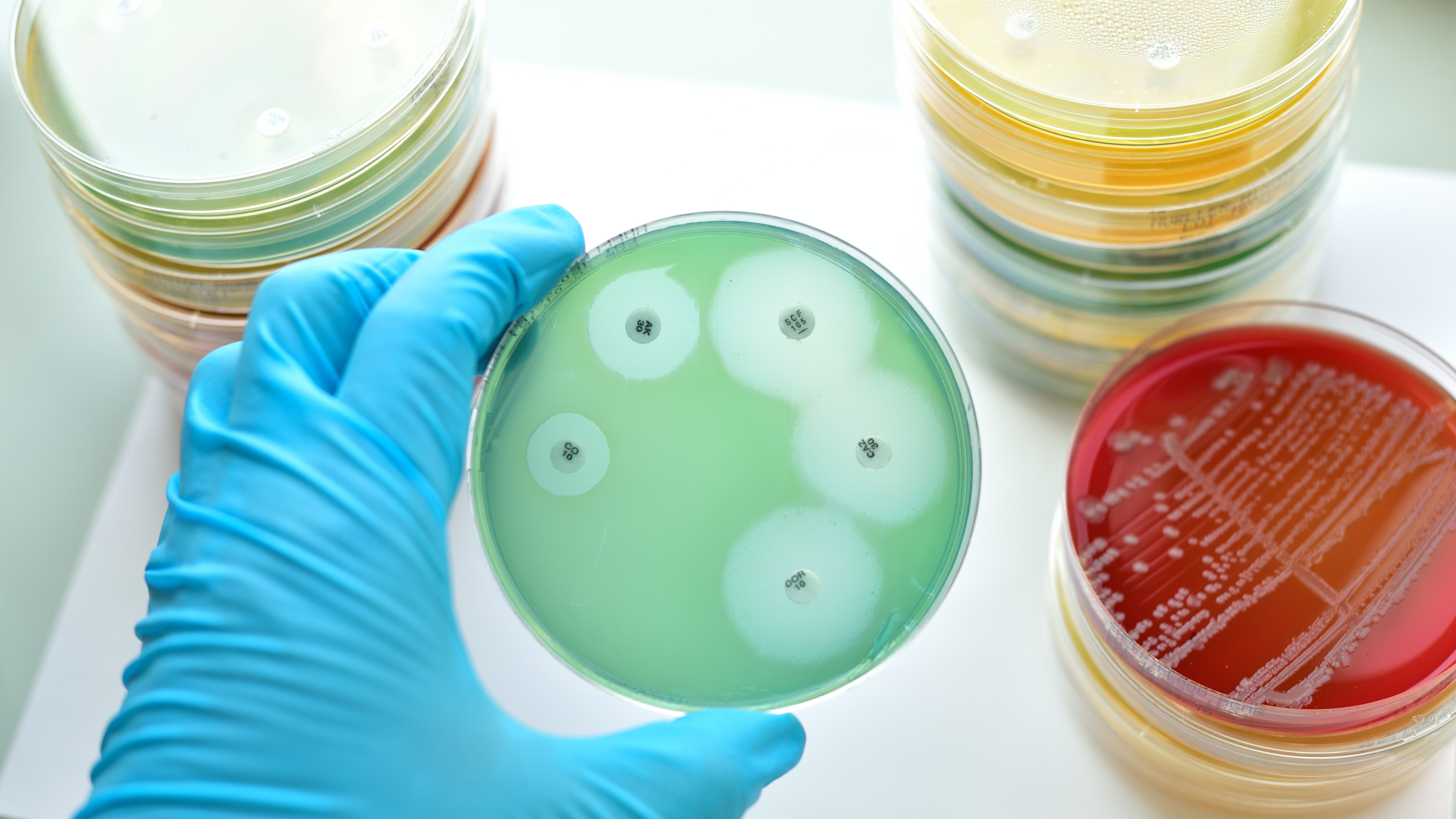 Microbiologie